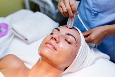 chemical-peel